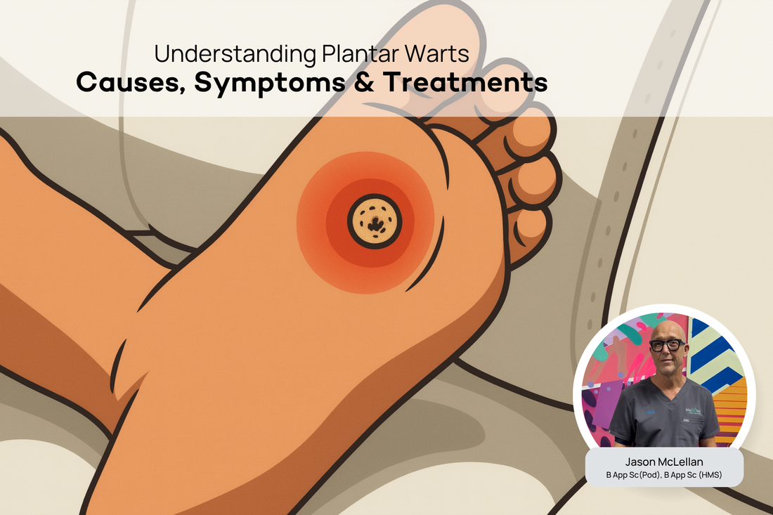 What are Plantar Warts? A Podiatrist Explains the Causes and Treatment